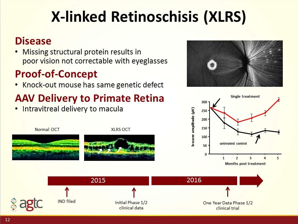 Slide 12