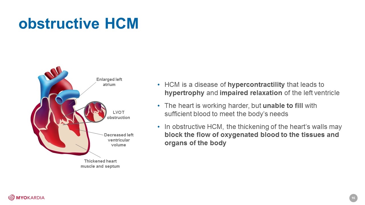 Slide 16