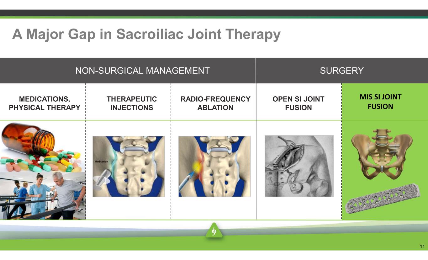 slide11