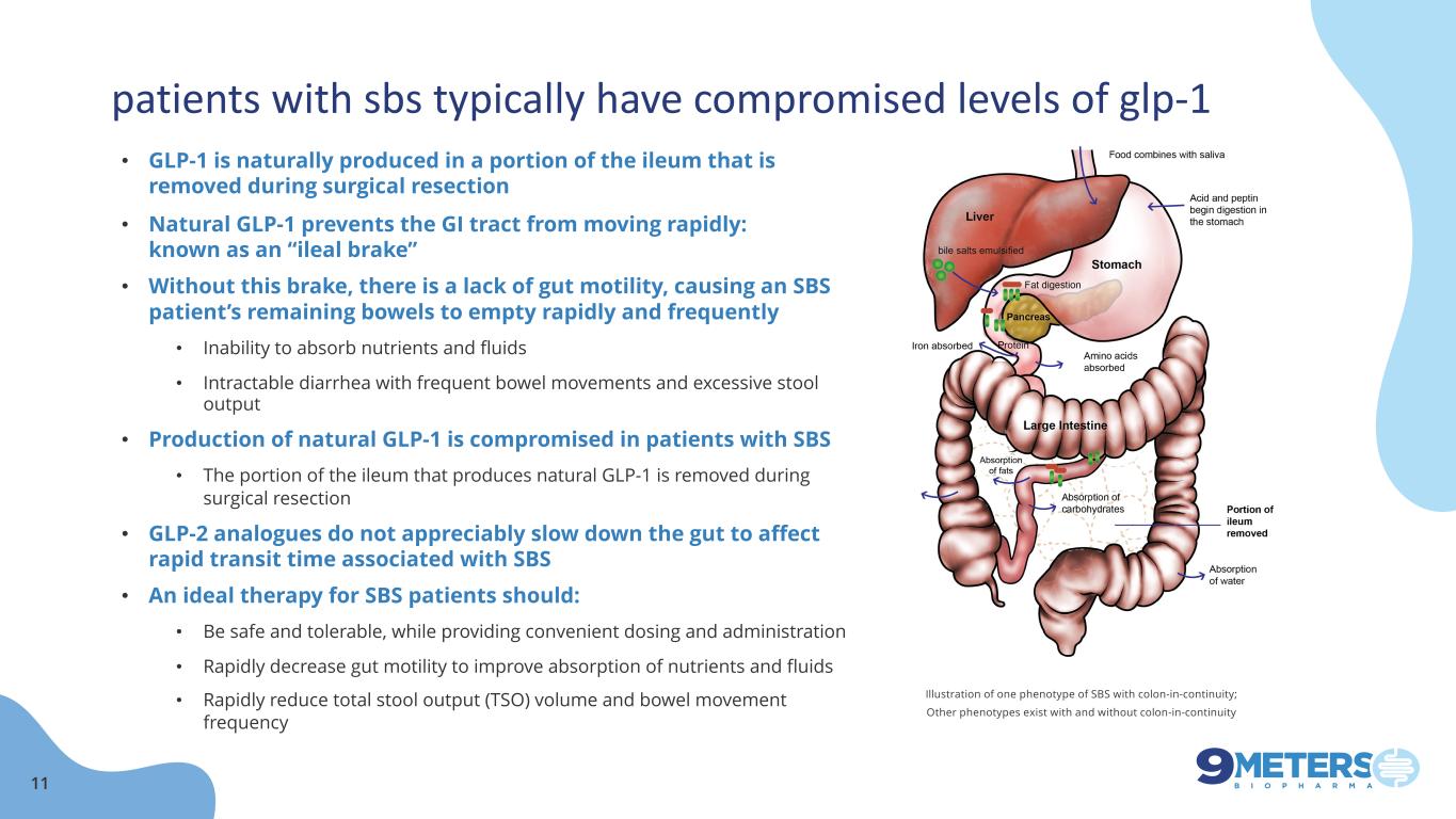 slide11